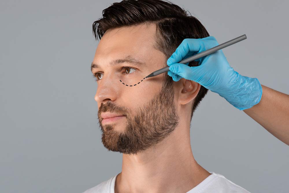 Handsome man with pencil marks under eyes for cosmetic surgery