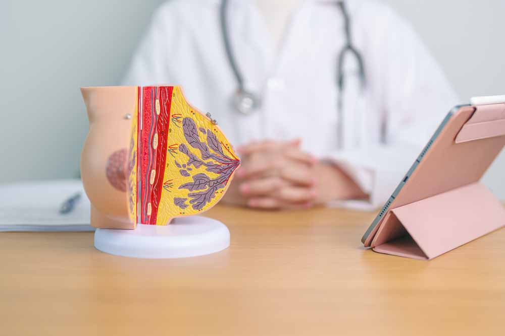 Doctor with Breast Anatomy model