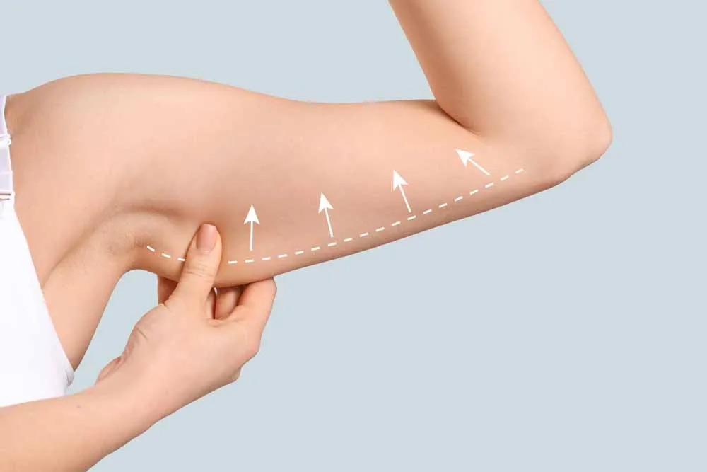 Markings on arm showing arm lift area