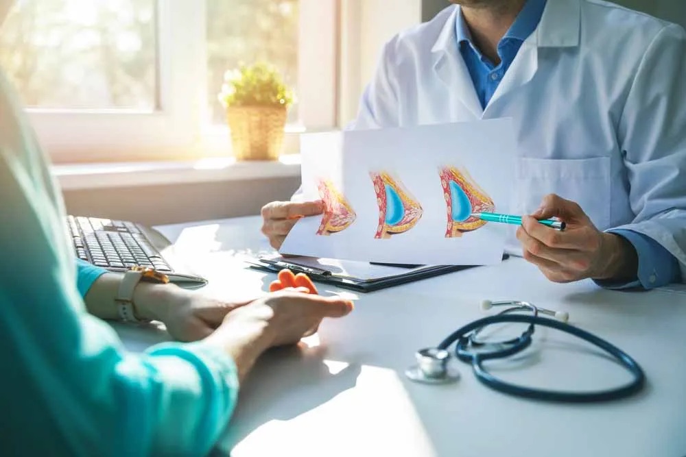 Doctor showing patient a breast diagram