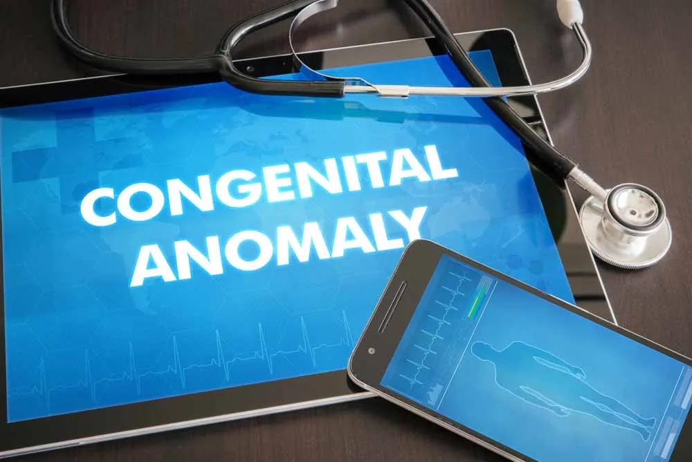 Congenital Anomalies